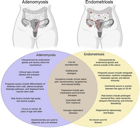 difference between adenomyosis endometriosis